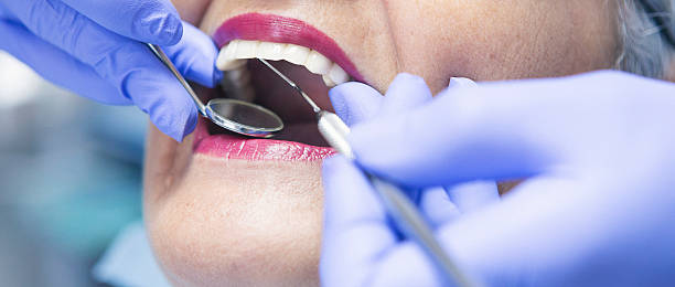 Best Emergency Root Canal Treatment in Rockford, IL