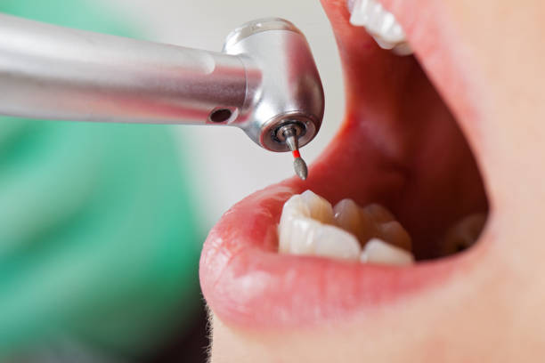 Best Emergency Dentist for Knocked-Out Tooth in Rockford, IL